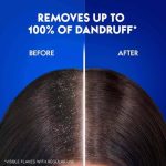 ⁦هيد اند شولدرز شامبو بالنعناع المنعش ضد القشرة - 600 مل⁩ - الصورة ⁦3⁩