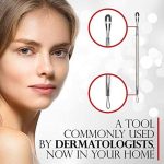 ⁦تيتانيا أداة التخلص من الرؤوس السوداء - 13.5 سم⁩ - الصورة ⁦4⁩