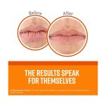 ⁦اوكيفيس مرطب شفاه غير معطر للشفاه الجافة والمتشققة - 4.2 جم⁩ - الصورة ⁦2⁩