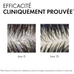 ⁦فيشي ديركوس شامبو ضد القشرة للعناية بالشعر الجاف - 390 مل⁩ - الصورة ⁦4⁩