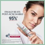 ⁦يوسرين سيروم ليلي ثلاثي المفعول لحب الشباب - 40 مل⁩ - الصورة ⁦3⁩