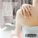 ⁦دي لا كروز مرهم الكبريت  لعلاج حب الشباب  73.7جم⁩ - الصورة ⁦7⁩