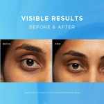 ⁦فيد اوت كريم الحماية المبيض لمنطقة حول العين - 15 مل⁩ - الصورة ⁦5⁩