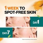 ⁦هيمالايا سيروم الكركم لإزالة البقع الداكنة  - 30 مل⁩ - الصورة ⁦4⁩