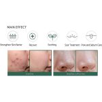 ⁦سوم باي مي كريم أحماض التقشير المعجزة - 60 جم⁩ - الصورة ⁦2⁩