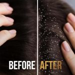 ⁦بانتين شامبو برو-في ضد القشرة 2 في 1 - 390 مل⁩ - الصورة ⁦4⁩