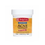 مرهم الكبريت دي لا كروز لعلاج حب الشباب