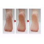 ⁦ام بيوتي جوارب القدم السحرية لتقشير القدمين باللافندر  - 40 جم⁩ - الصورة ⁦4⁩